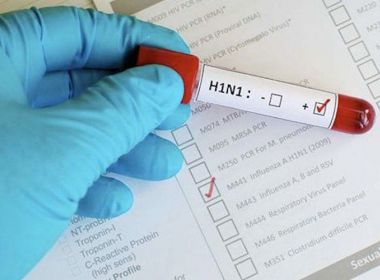 Idoso de 69 anos morre por H1N1; caso é o 9º registrado em Salvador