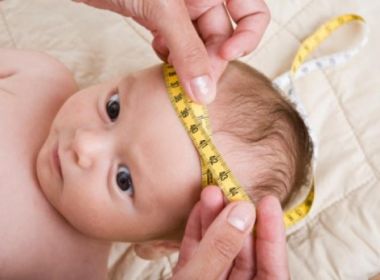 Estudo identifica 2 casos de reversão da microcefalia em bebês de mães com zika