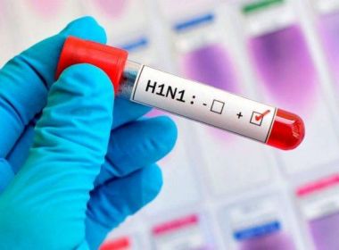 Quase metade das vÃ­timas fatais de H1N1 na BA em 2019 nÃ£o estava em faixa etÃ¡ria 'de risco'