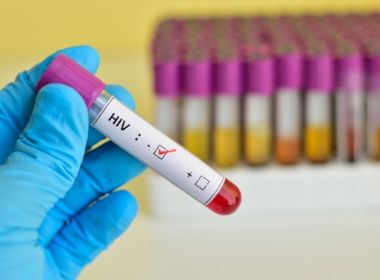 ONU estima que 1,7 milhÃ£o de pessoas foram infectadas pelo HIV em 2018