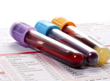Nordeste de Amaralina recebe ação de saúde com foco em prevenção e combate às hepatites