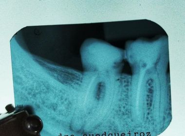 'Valor da saúde': Em busca de dentistas mais baratos, pacientes são vítimas de fraude