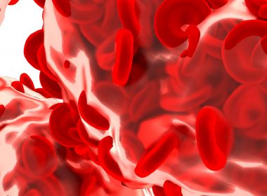 Casos de demência podem ter relação com anemia, apontam cientistas