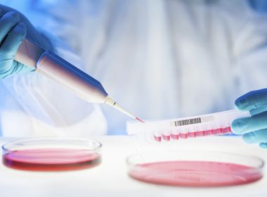 Pesquisa identifica bactérias multirresistentes fora do ambiente hospitalar no interior de SP
