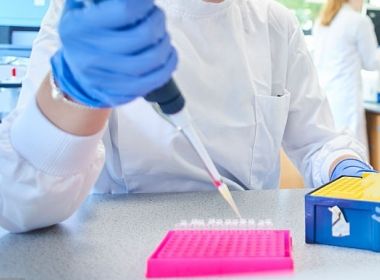 Cientistas identificam novo tipo do vírus HIV; descoberta pode auxiliar em novos tratamentos
