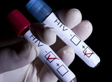 Sesab confirma 20 casos de HIV no Carnaval de Salvador