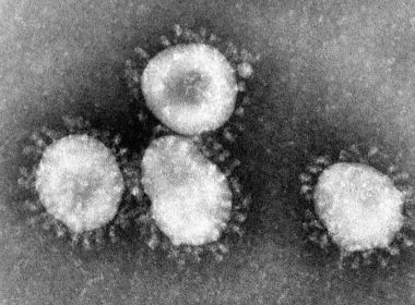 Sobe para 17 o número de casos com suspeita do novo coronavírus, diz Sesab