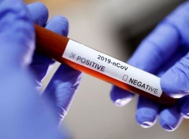 Brasil registra 77 mortes e 2.915 casos confirmados do novo coronavírus