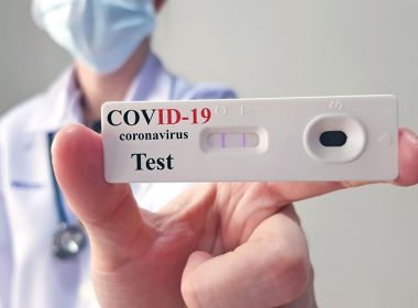 Entidade recomenda que farmácias não ofertem testes rápidos de Covid-19 