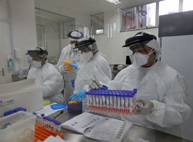 Brasil vai a 21.048 mortes e 330.890 mil casos confirmados do novo coronavírus