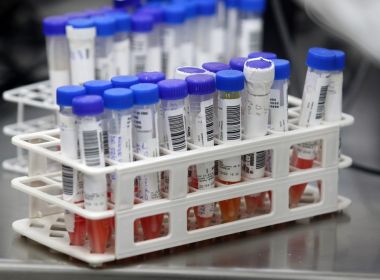 Bahia registra 2.965 novos infectados e 54 novas mortes por Covid em 24 horas