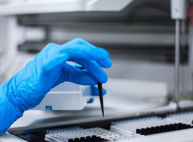 Soro com anticorpos de cavalo será testado em voluntários com Covid-19 na Argentina