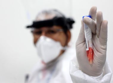 Bahia é o terceiro estado brasileiro em número de casos confirmados da Covid-19