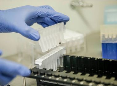 Ministério da Saúde tem 9,5 milhões de testes para Covid-19 estocados por falta de insumos