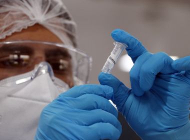 Brasil registra mais de 30 mil novos casos e chega a 126.203 mortes por Covid-19