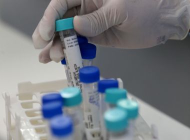 Recorde de mortes por Covid-19 foi maior do que o registrado por boletins da Sesab