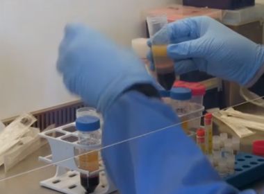 Fiocruz prevê fabricação de 130 milhões de doses da vacina de Oxford em 2021 