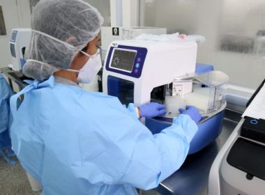 Sesab duplica velocidade de análise dos exames RT-PCR para a Covid-19