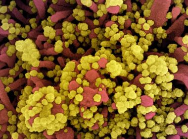 Cientistas descobrem variante do coronavírus em BH; cepa é combinação de 18 mutações