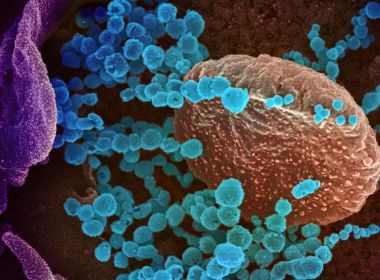 Danos a órgãos vitais e tecidos são identificados em crianças que morreram por Covid-19