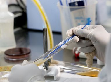 Vilas-Boas alerta para aumento progressivo do número de casos ativos na Bahia