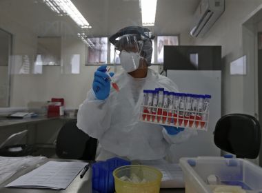 Brasil já contabiliza 247 registros de infectados e 21 mortes pela variante Delta