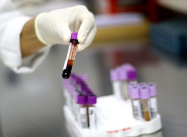 Pesquisadores querem retomar estudo brasileiro que busca cura do HIV até o fim do ano