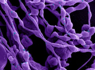 Brasil tem 570 casos confirmados de infecção pela variante Delta