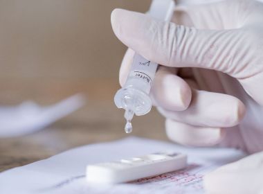 Anvisa autoriza o uso de autotestes para Covid-19 no Brasil