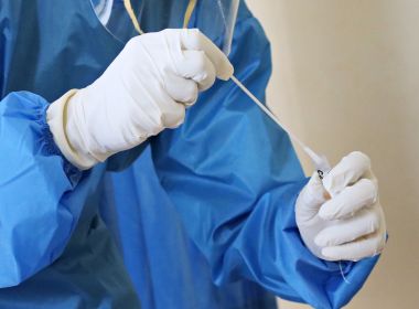 Isolado há 14 meses, homem testa positivo para Covid por 78 dias seguidos