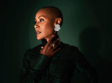 Perda de cabelo em formas circulares é o sintoma mais comum da alopecia