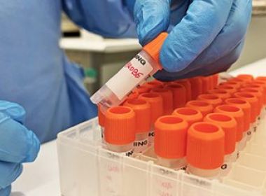 Bahia registra primeiro caso suspeito de varíola do macaco