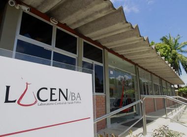 Bahia tem trinta casos confirmados de varíola dos macacos