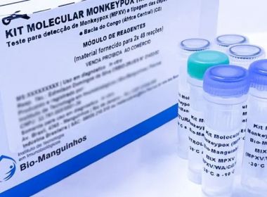 Anvisa aprova registro do 1º teste de detecção da monkeypox no país