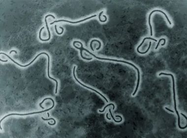 Surto de Ebola: mortes em Uganda sobem para 21 em menos de uma semana