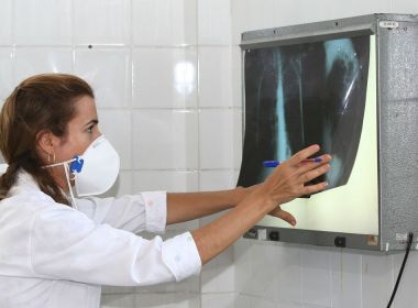 OMS alerta para alta de casos subnotificados de tuberculose no mundo