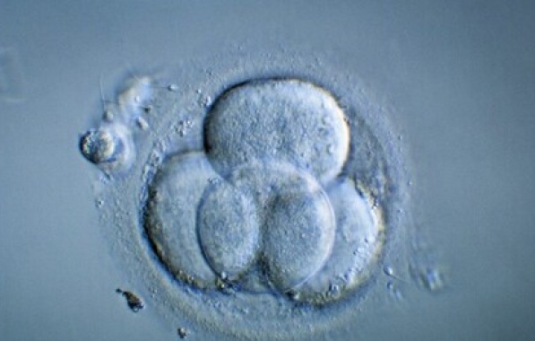 Cientistas anunciam criação de primeiro embrião humano sintético ...