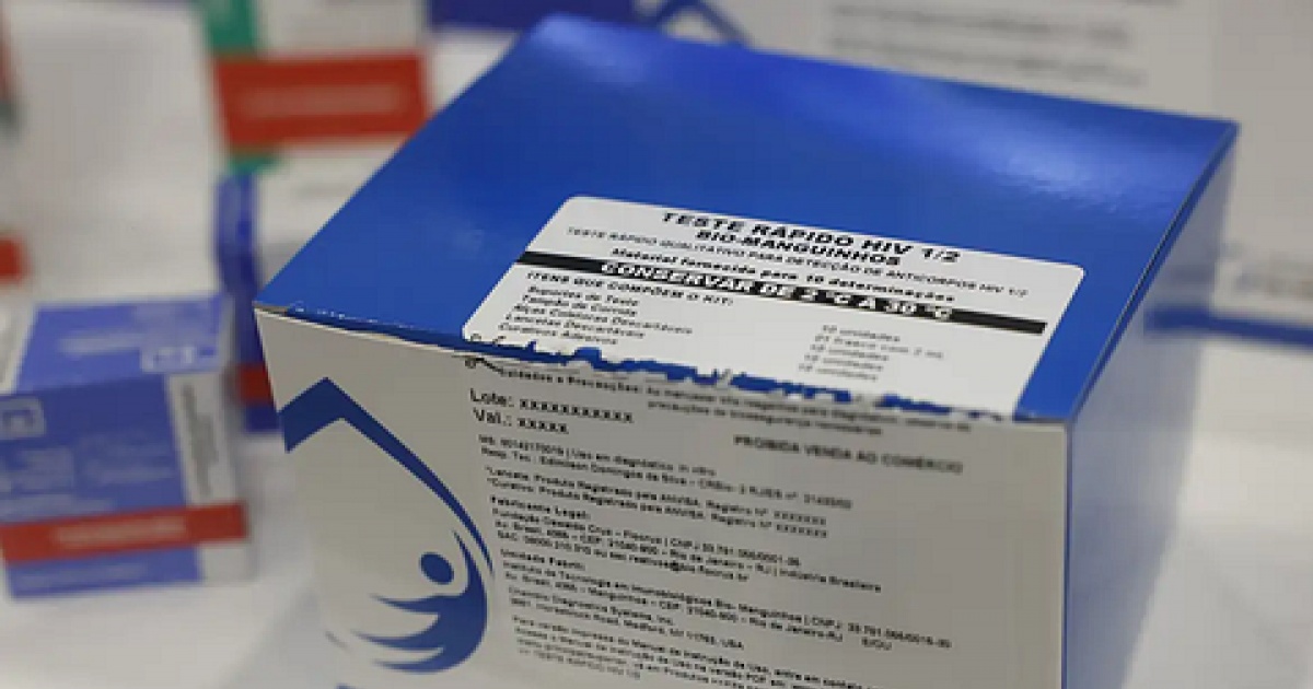 Fiocruz vai ampliar produção de kits diagnósticos para o SUS