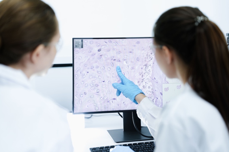 Novo medicamento para linfoma não Hodgkin é aprovado pela Anvisa 