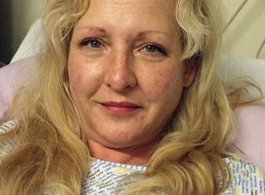 Mulher processa ex-namorado alegando que pênis grande alargou sua vagina